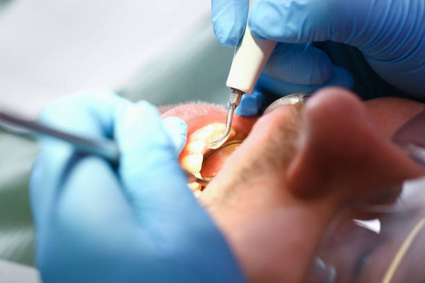 Best Emergency Dental Care for Broken or Chipped Teeth in Waynesboro, PA