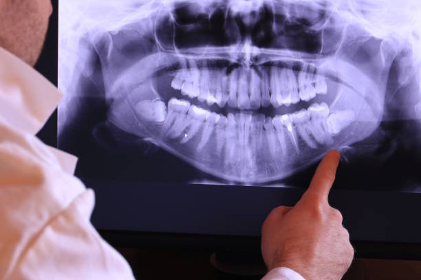 Best Emergency Gum Treatment in Waynesboro, PA
