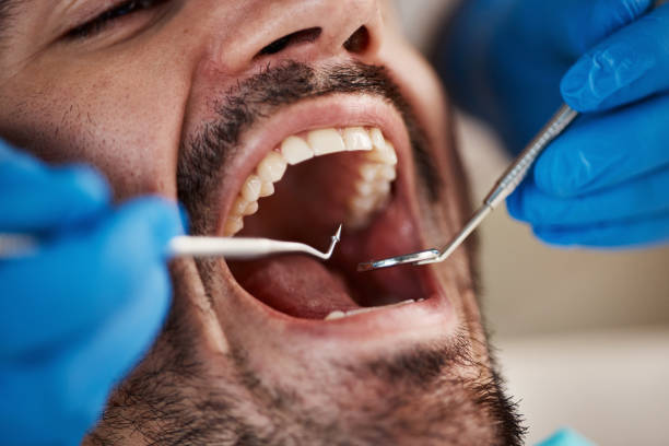 Best Emergency Treatment for Dental Infections or Abscesses in Waynesboro, PA